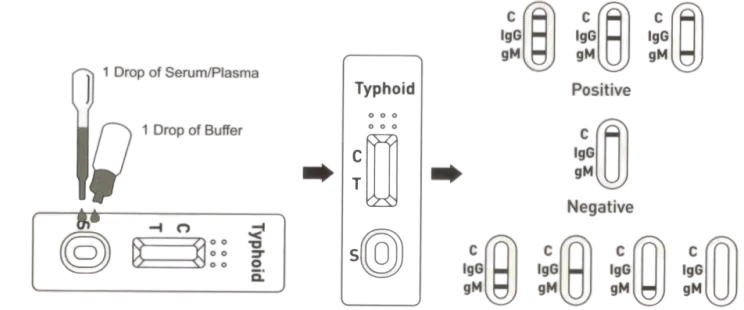 Typhoid-removebg-preview-removebg-preview (1)