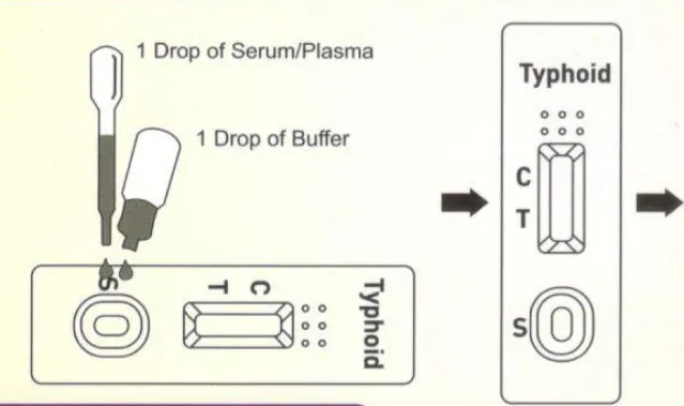 Typhoid